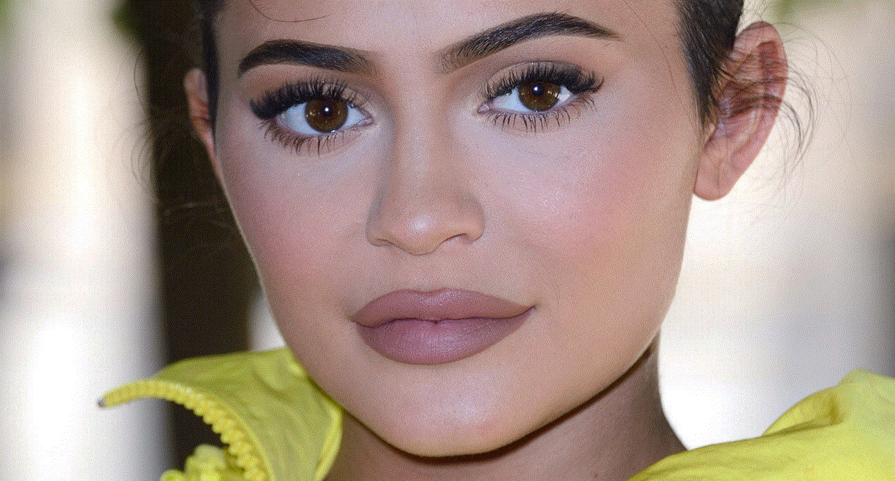 KYLIE JENNER DUDAK SİLİKONLARINI ÇIKARDI
