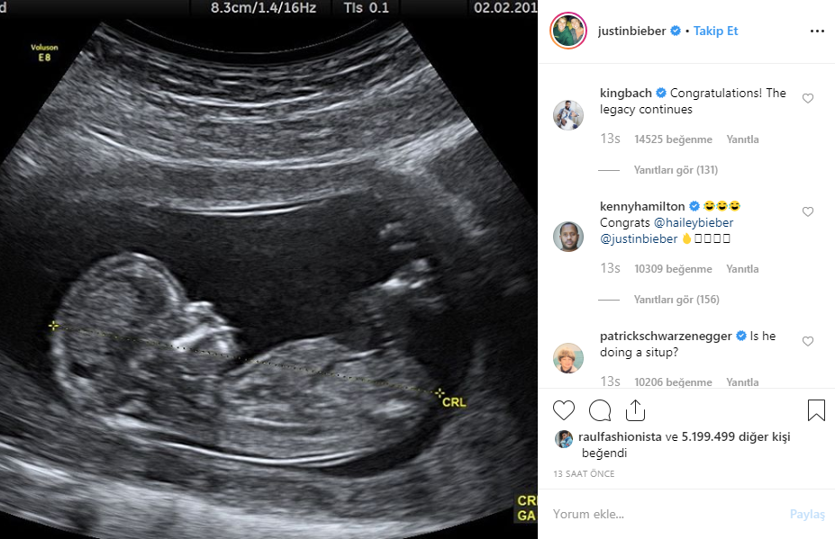 JUSTIN BIEBER VE HAILEY BALDWIN HERKESİ KANDIRDI